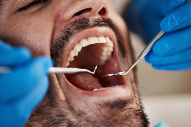 Best Urgent Care for Lost Fillings or Crowns in Hwatha, IA