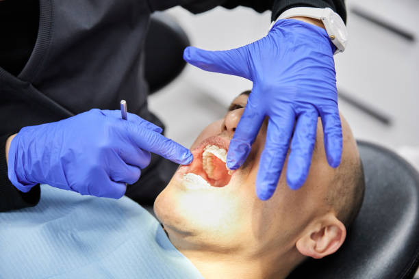 Best Emergency Wisdom Teeth Removal in Hwatha, IA